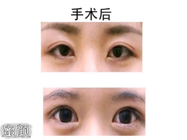 案例图片