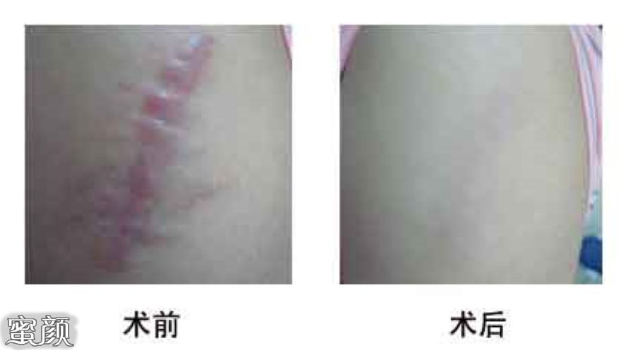 https://img.yiyiaimei.com/mnt/Editor/2020-09-26/5f6ef7699740c.jpg