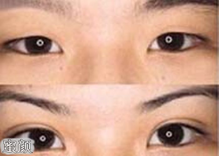 案例图片
