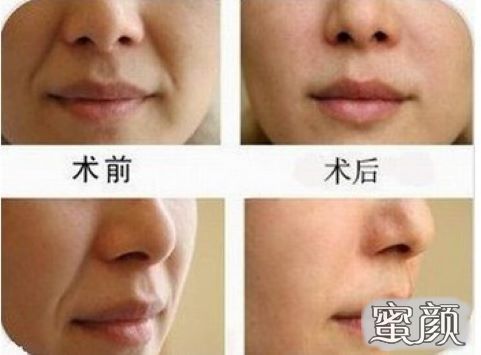 案例图片