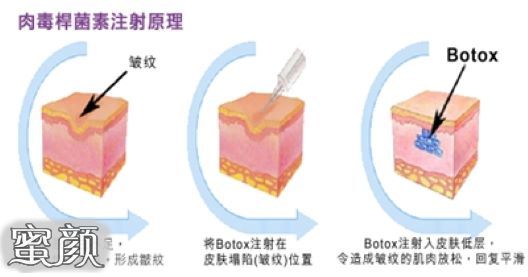 案例图片