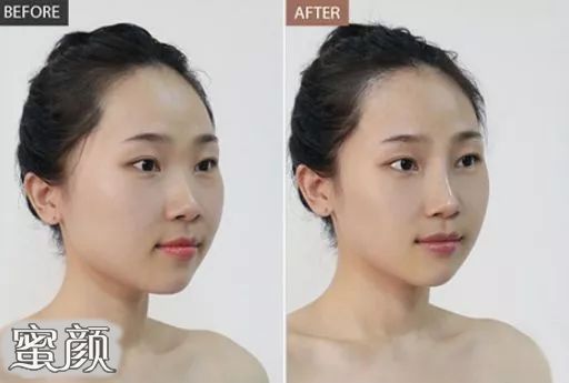 案例图片