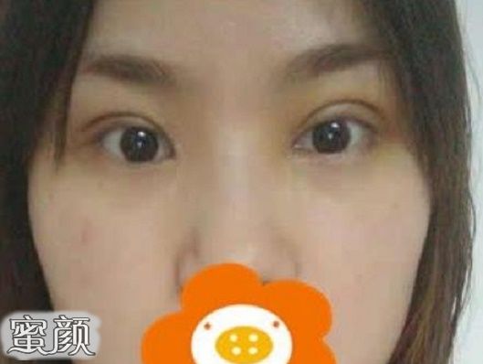 案例图片