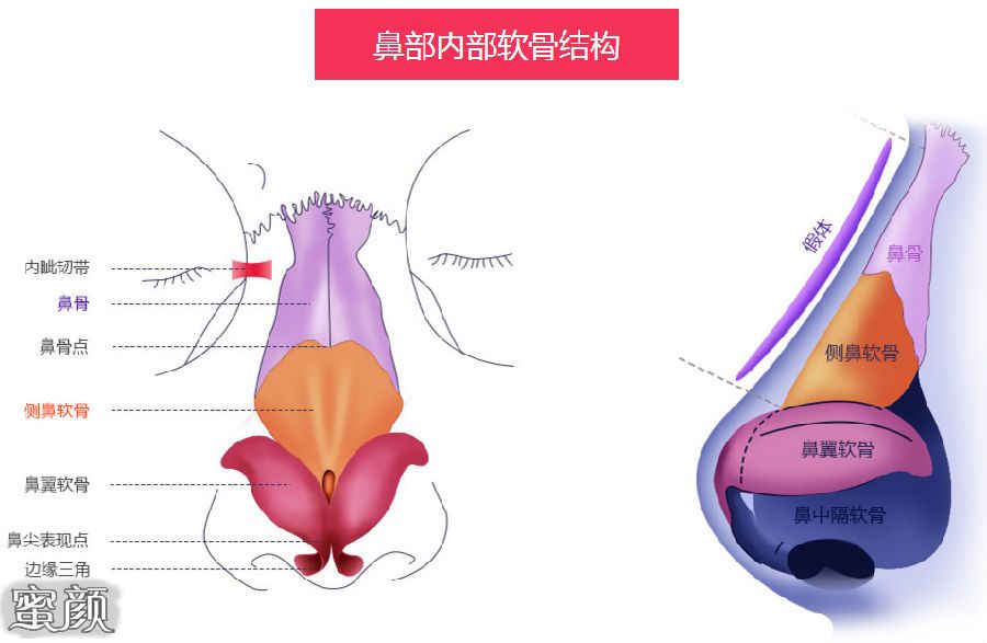 案例图片