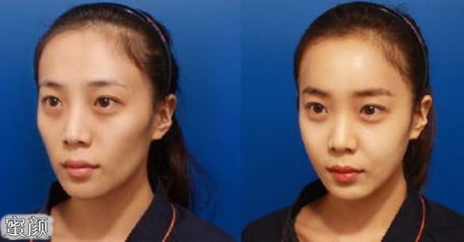 https://img.yiyiaimei.com/mnt/Editor/2020-10-04/5f79d3e99773c.jpg