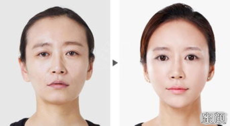 https://img.yiyiaimei.com/mnt/Editor/2020-10-04/5f79d3f44bace.jpg