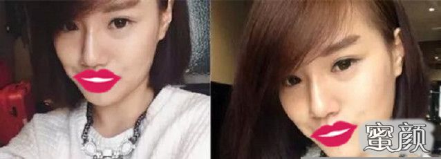 案例图片