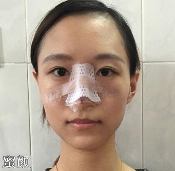 案例图片