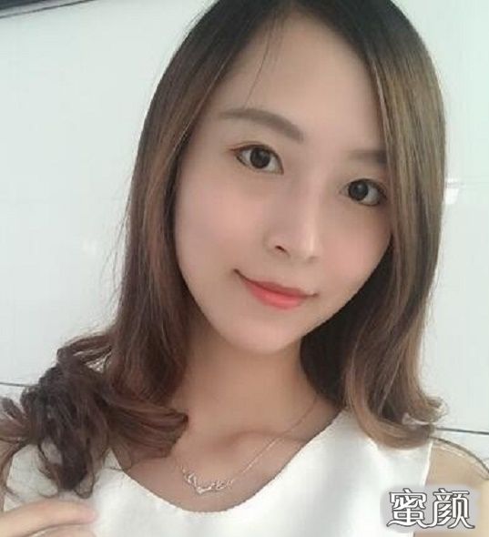 案例图片