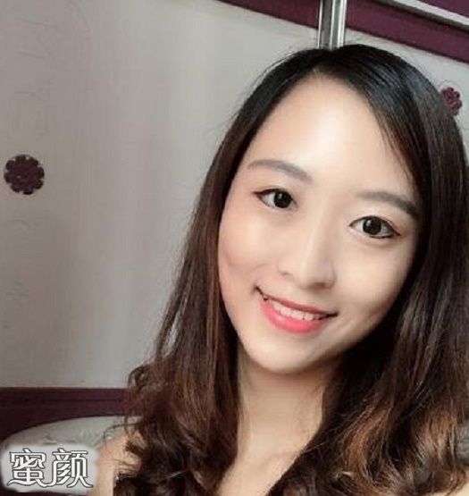 案例图片