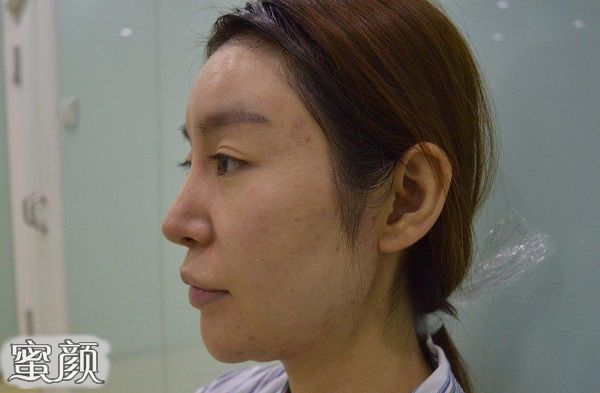 https://img.yiyiaimei.com/mnt/Editor/2020-10-08/5f7eae73bfd82.jpg