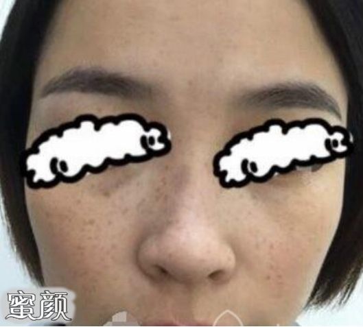 案例图片