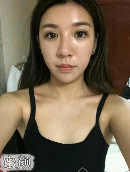 案例图片