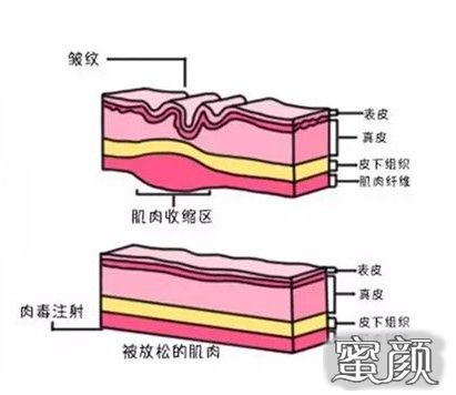 案例图片