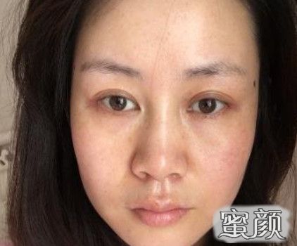 案例图片