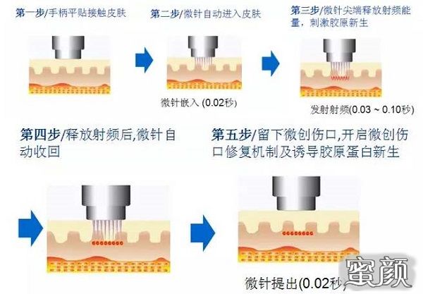 案例图片