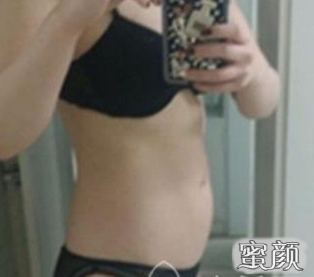 https://img.yiyiaimei.com/mnt/Editor/2020-10-12/5f83917083f48.jpg