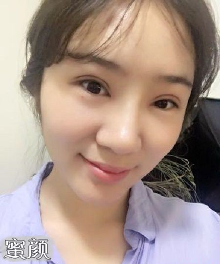 案例图片