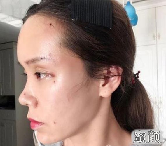 案例图片