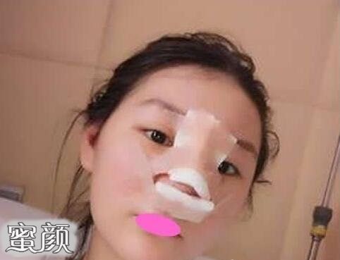 案例图片