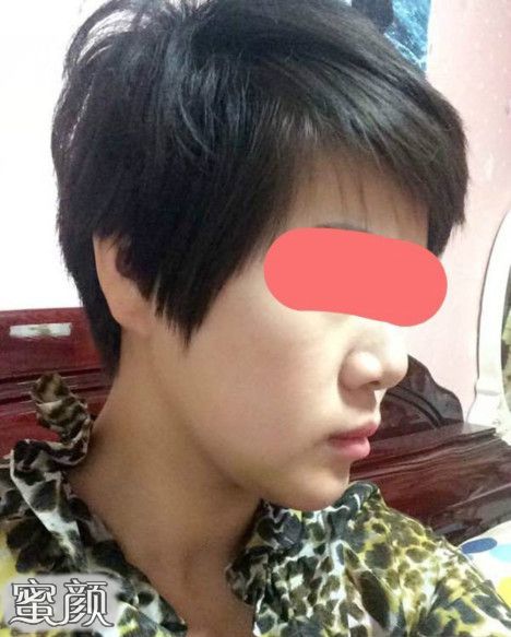 案例图片