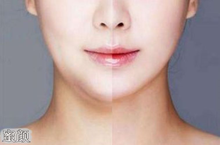 https://img.yiyiaimei.com/mnt/Editor/2020-10-17/5f8abe35355c0.jpg