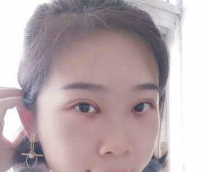 案例图片