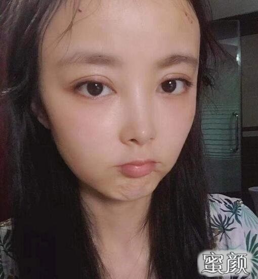 案例图片