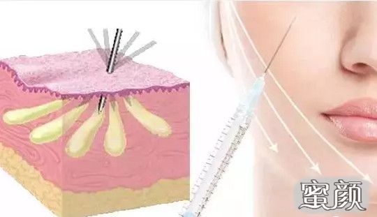 https://img.yiyiaimei.com/mnt/Editor/2020-10-19/5f8d26d85509a.jpg