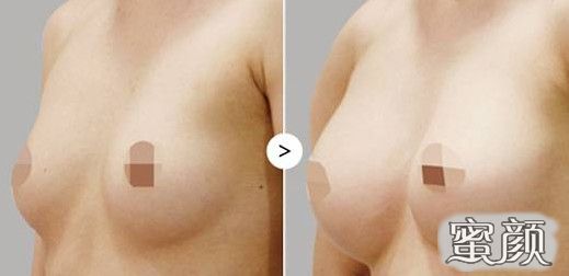 https://img.yiyiaimei.com/mnt/Editor/2020-10-19/5f8d26e84fec3.jpg