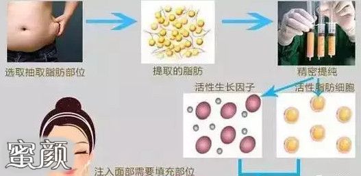 https://img.yiyiaimei.com/mnt/Editor/2020-10-19/5f8d26f739551.jpg