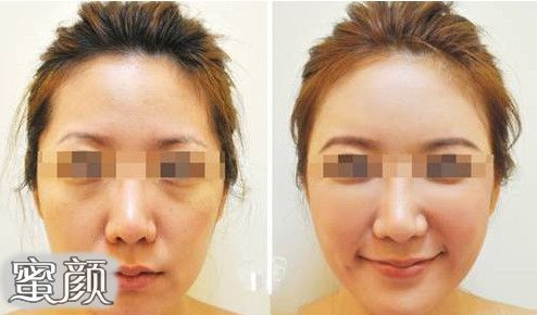 https://img.yiyiaimei.com/mnt/Editor/2020-10-19/5f8d271909d36.jpg