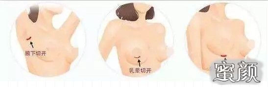 案例图片