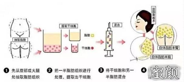 案例图片