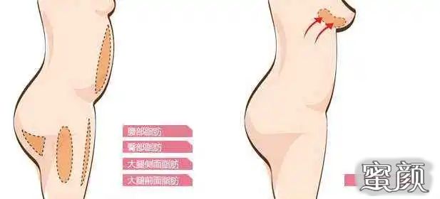 案例图片