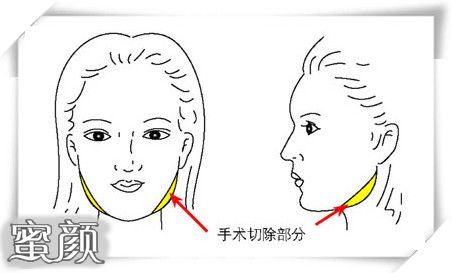 https://img.yiyiaimei.com/mnt/Editor/2020-10-19/5f8d8aff6aa67.jpg