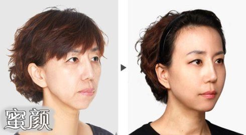https://img.yiyiaimei.com/mnt/Editor/2020-10-22/5f90c6072c041.jpg