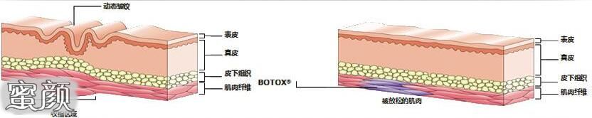 案例图片