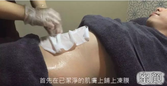 案例图片