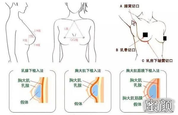 案例图片