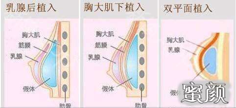 案例图片