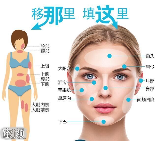 案例图片