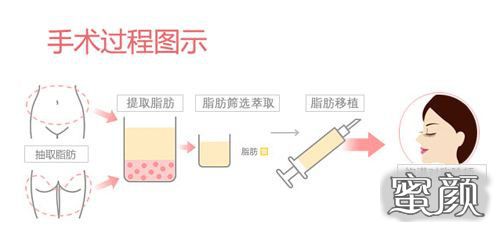 案例图片