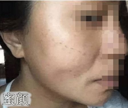 案例图片