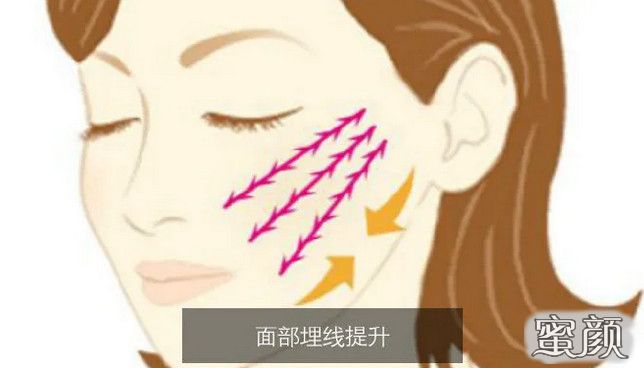 案例图片