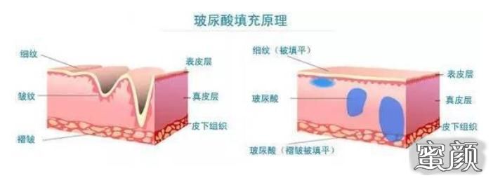 案例图片