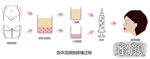 案例图片