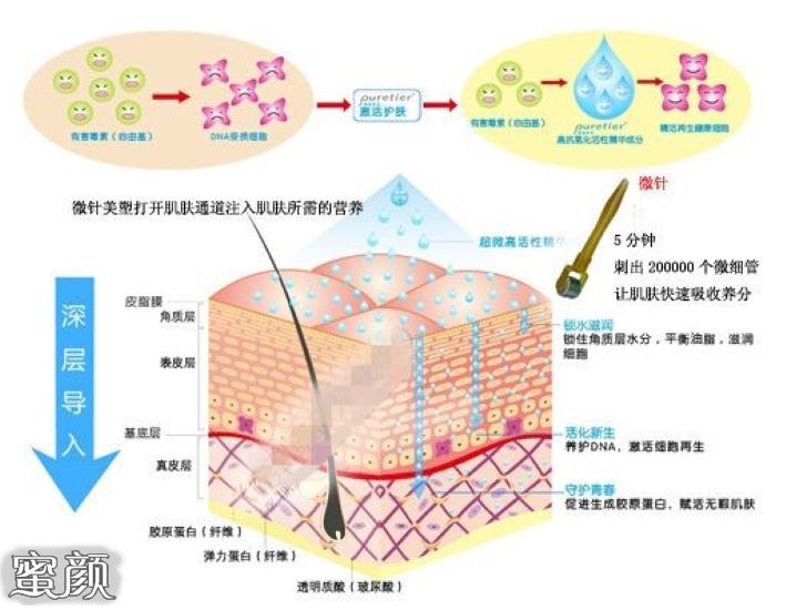 案例图片