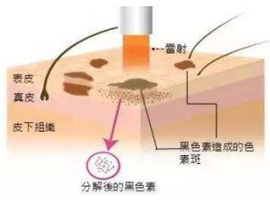 案例图片