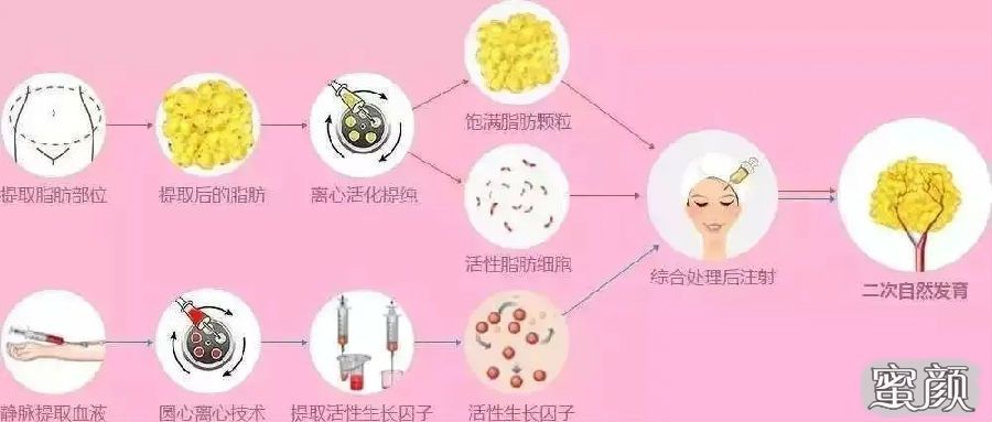 案例图片